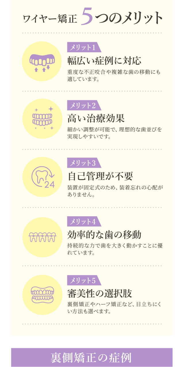 ワイヤー矯正５つのメリット