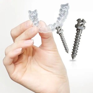 アンカースクリュー